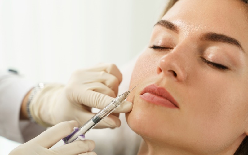 dermal filler application